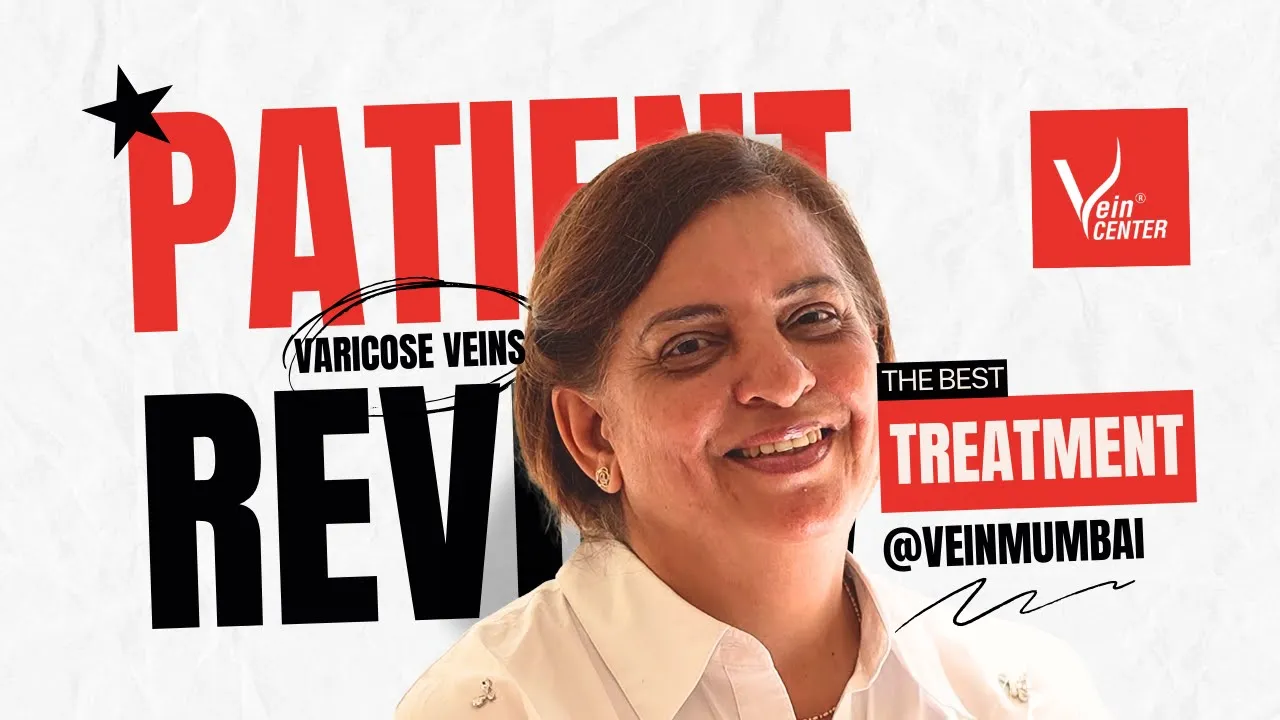 her story overcoming varicose veins and rediscovering life patient reviews