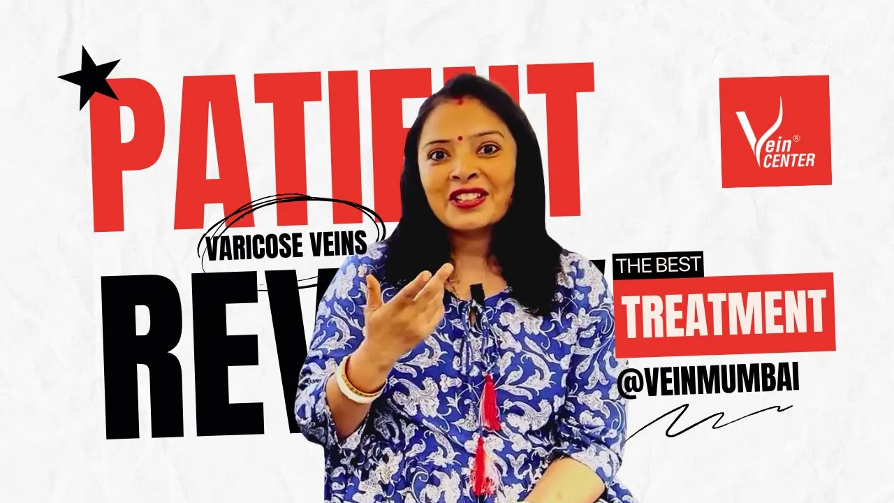 large varicose veins before after and patient review