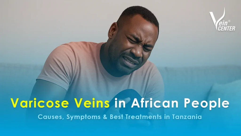Varicose Veins in African People – Causes, Symptoms & Best Treatments in Tanzania varicose veins in african people – causes, symptoms & best treatments in tanzania