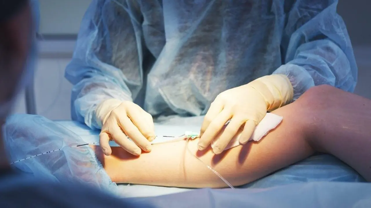 Treatment For Varicose Veins evla evlt laser treatment procedure varicose veins venous ulcers vein center tanzania