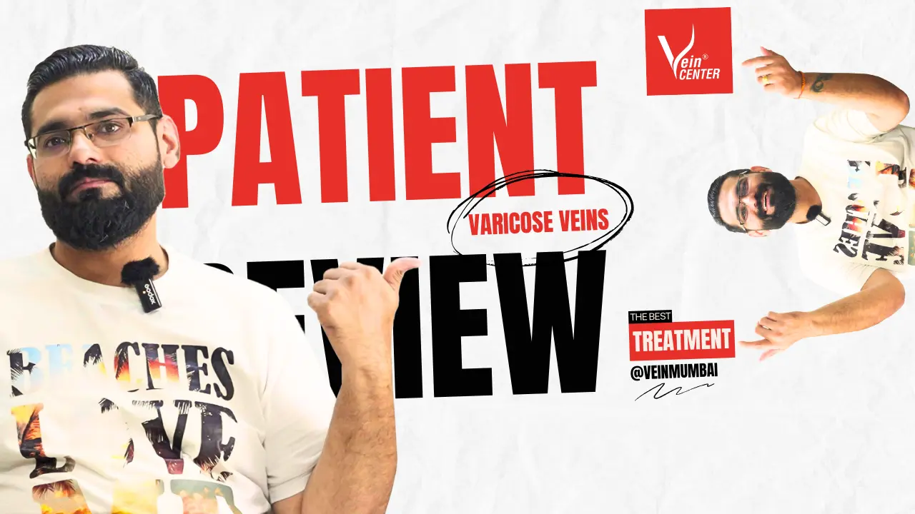 varicose veins patient review by dhruv from thane