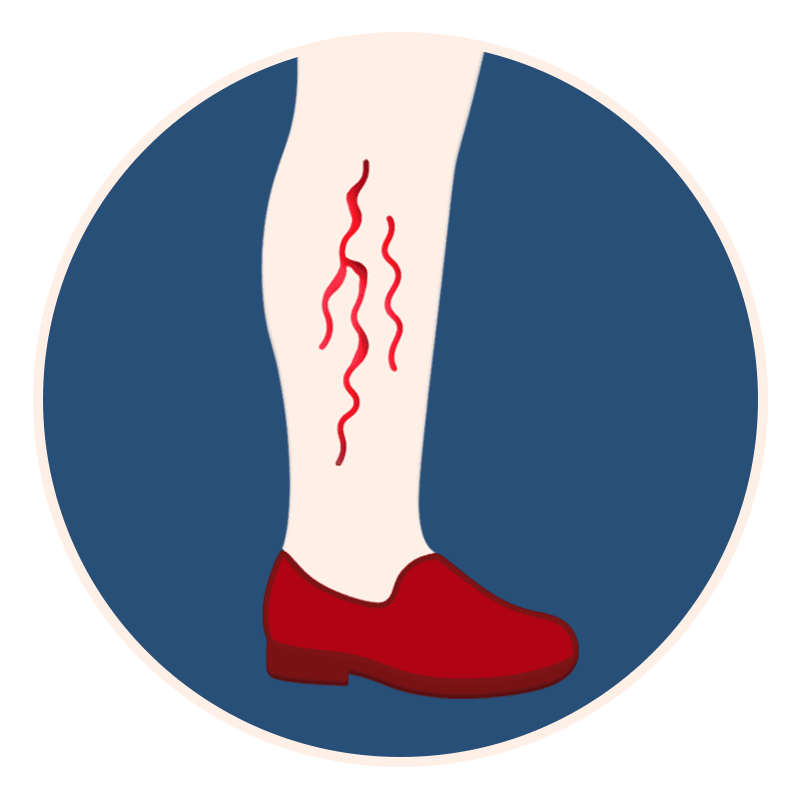 varicose veins blue round.png